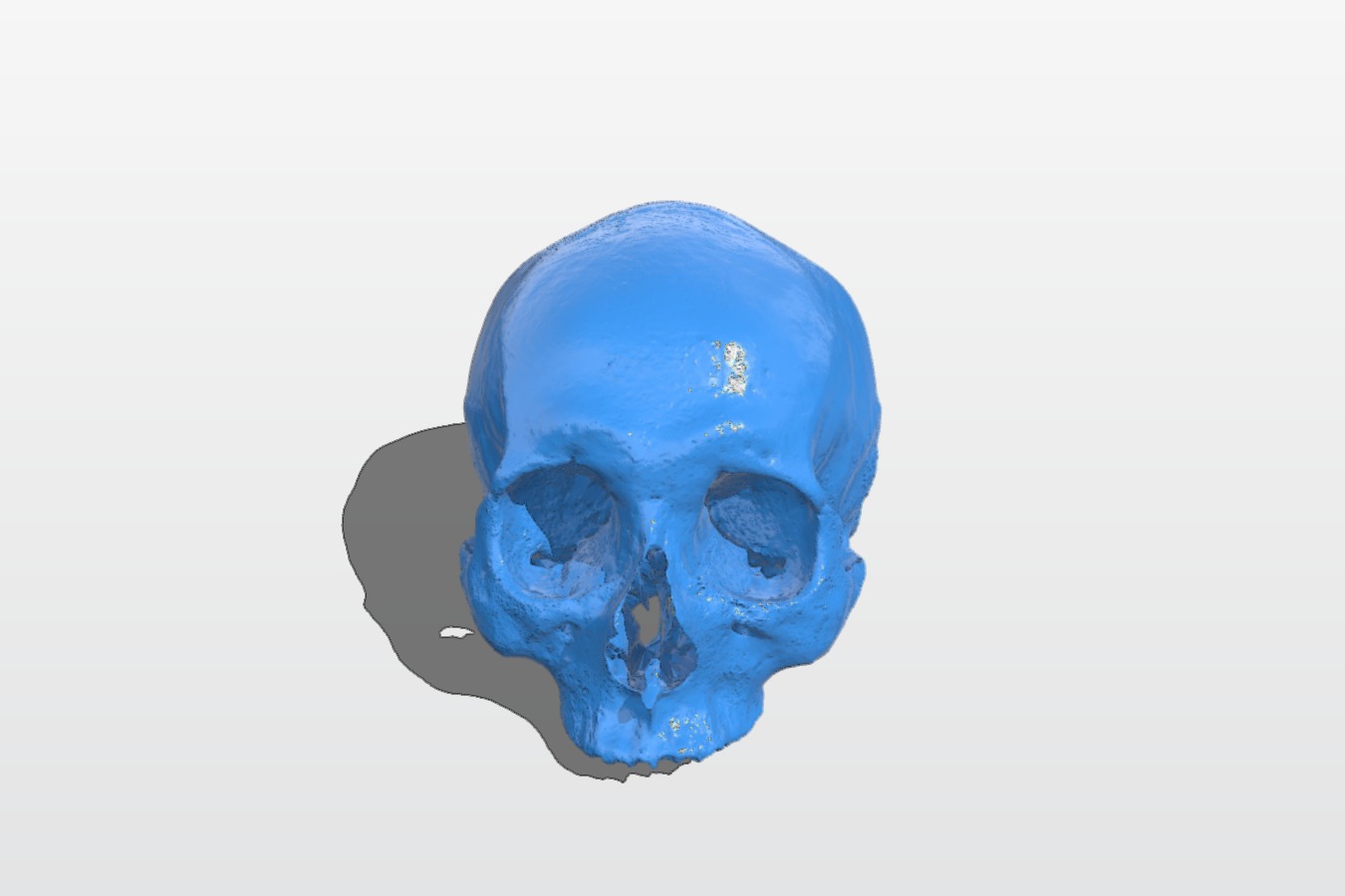 Human skull (Homo sapiens)