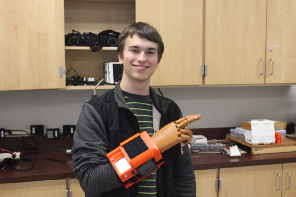 Robotic Prosthesis | 3d print model