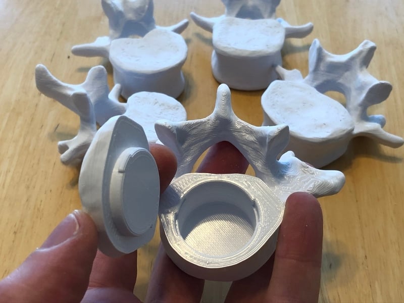 Vertebrae with Secret Compartment