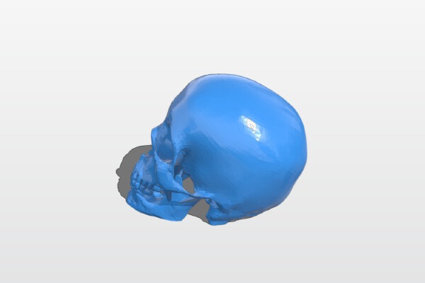 Human Skull Solid No Supports Needed Renforced Mandibl_teeth | 3d print model