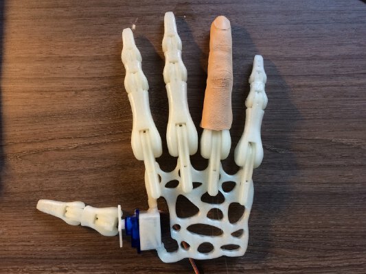 Robot hand    bionic hand prosthesis prototype | 3d print model