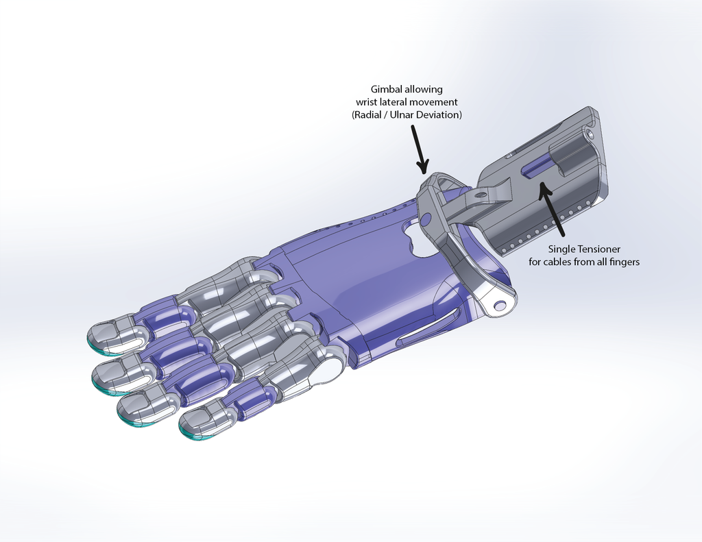 Cathy's Lucky Fin V2 - Prosthetic Hand - Bowden _ Push-Pull Variant