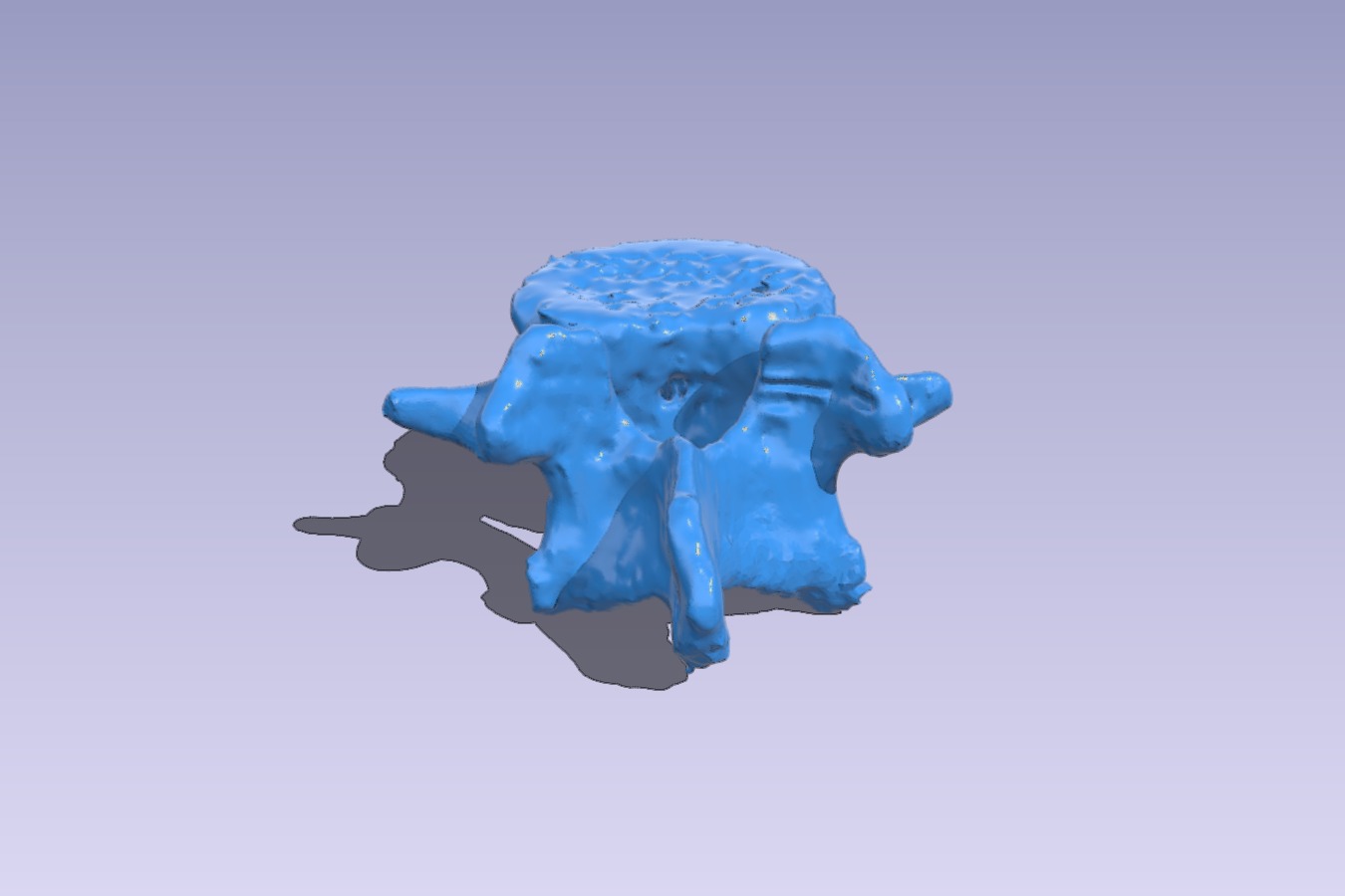 lumbar vertebrae