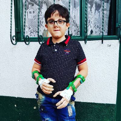Promimetic Hand | 3d print model
