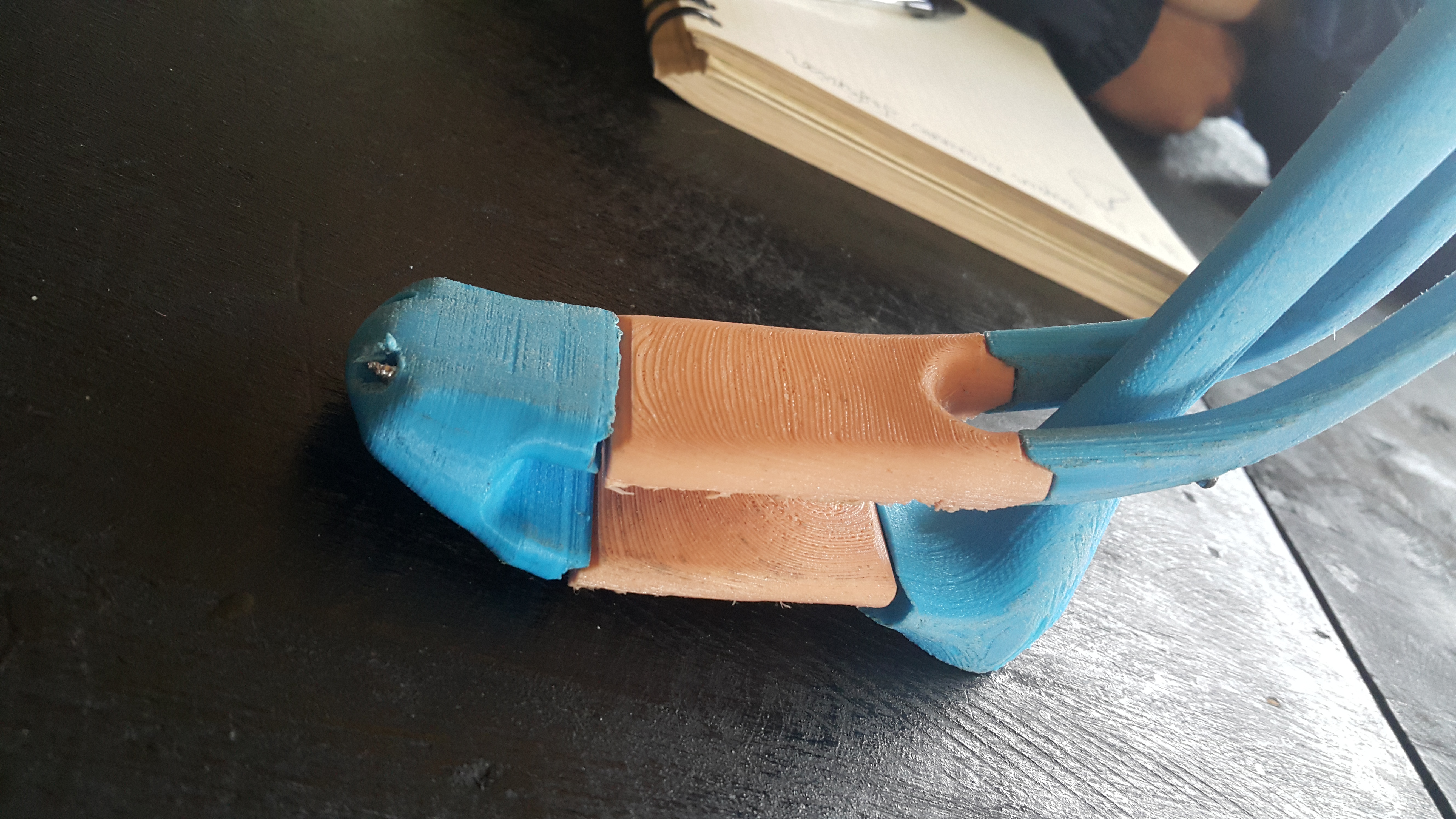 prótesis transfemoral para miembro inferior con materiales reciclados y con tecnología de impresión 3D