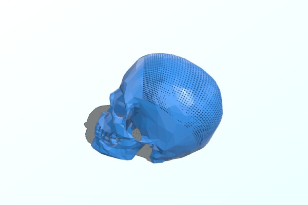 Customizable Stereographic Skull lowres | 3d print model