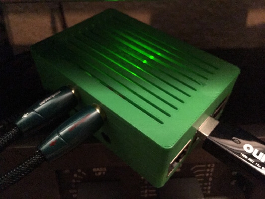 Raspberry Pi 2 with Hifiberry DAC Case | 3d print model