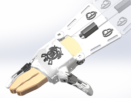e-NABLE Phoenix Hand v2 - Three fingers removed | 3d print model