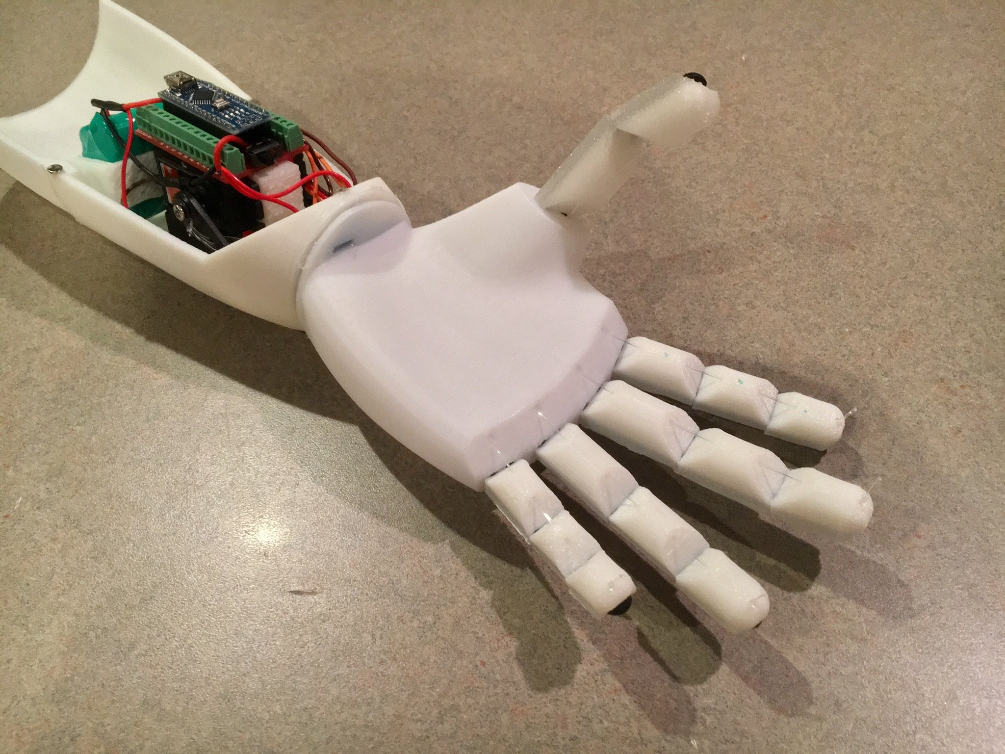 Robotic Prosthetic Hand