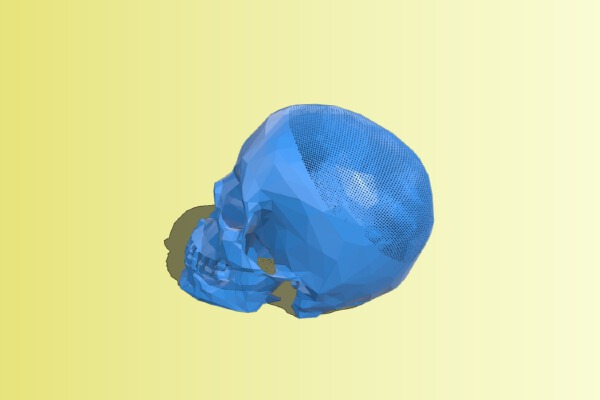  Customizable Stereographic Skull v3 | 3d print model