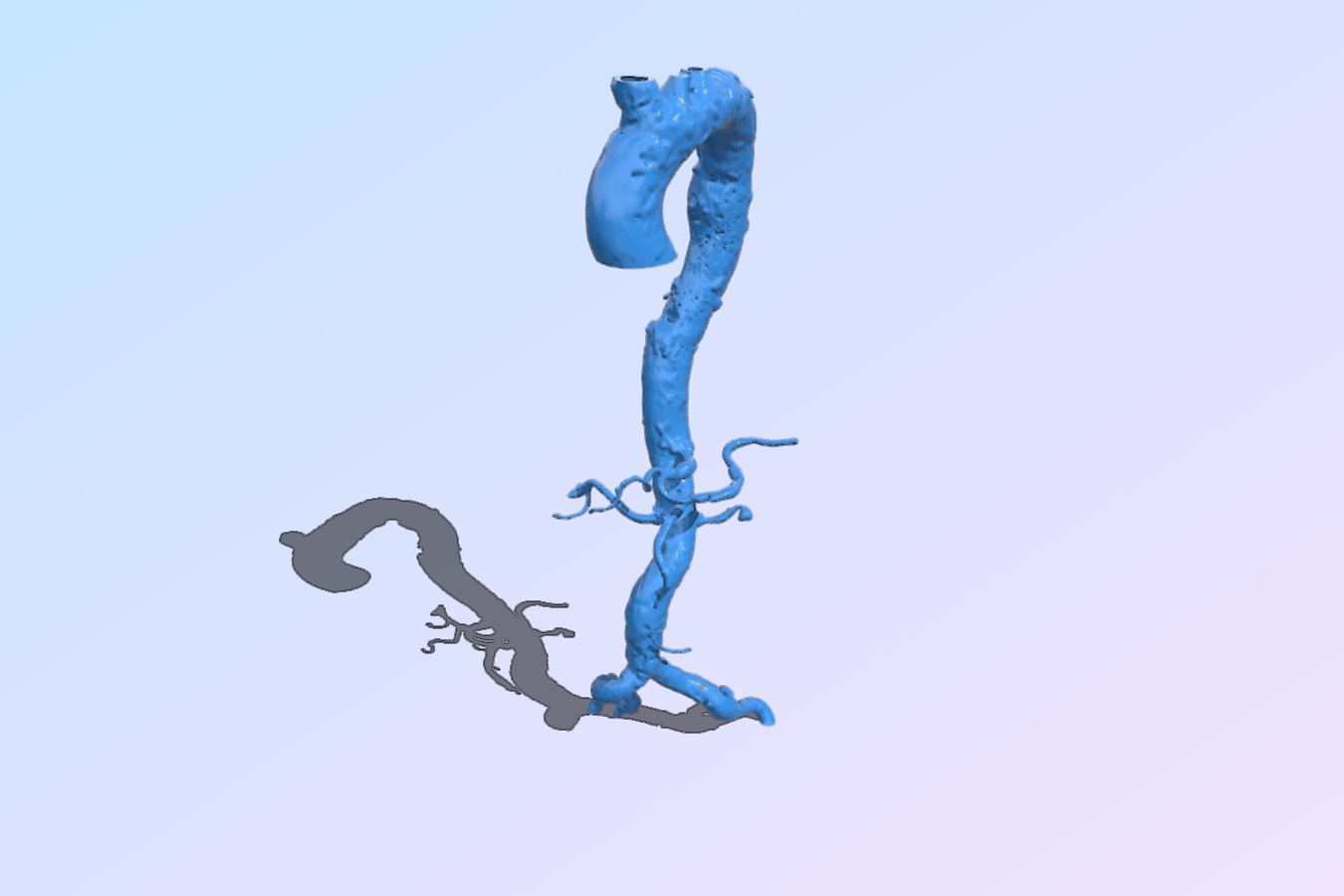 Aorta
