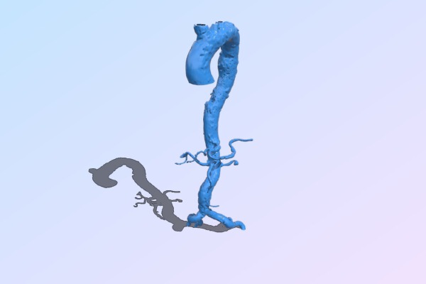Aorta | 3d print model
