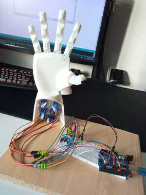 Bionic Hand with 5 individual fingers | 3d print model