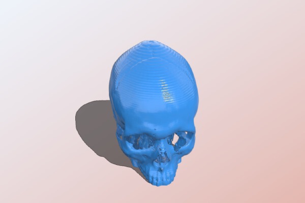 ct scan | 3d print model