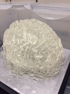 Brain MRI Scan