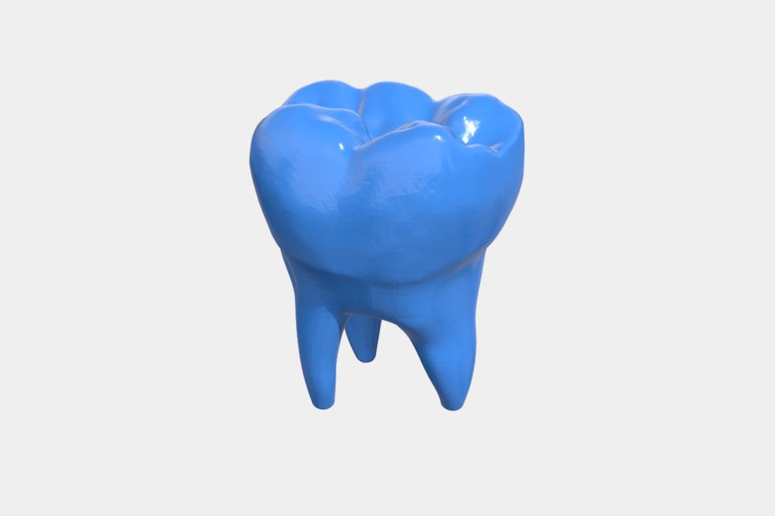 Tooth 5