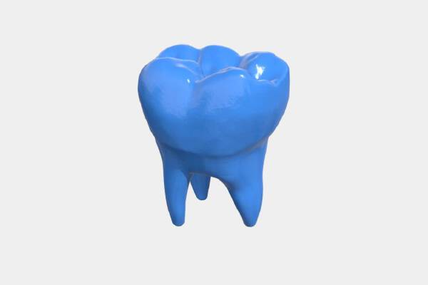 Tooth 5 | 3d print model