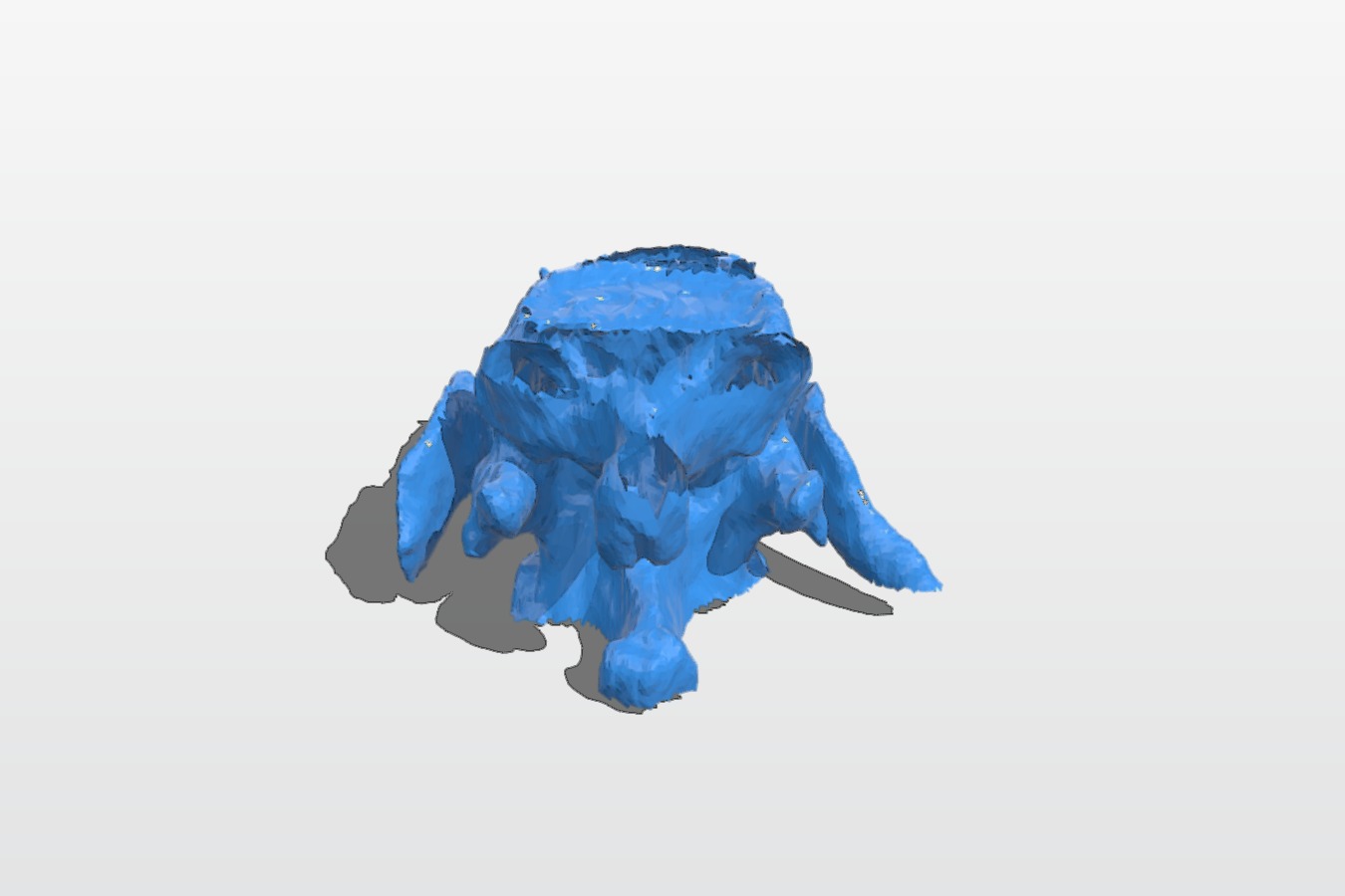 Vertebrae (MRI)