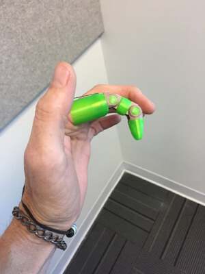 Knick's Prosthetic Finger | 3d print model