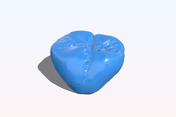 Dental Crown | 3d print model