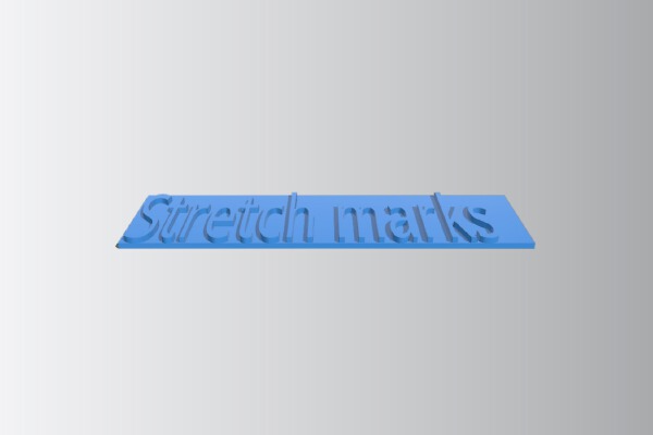 Stretch marks from shrek the 3rd | 3d print model