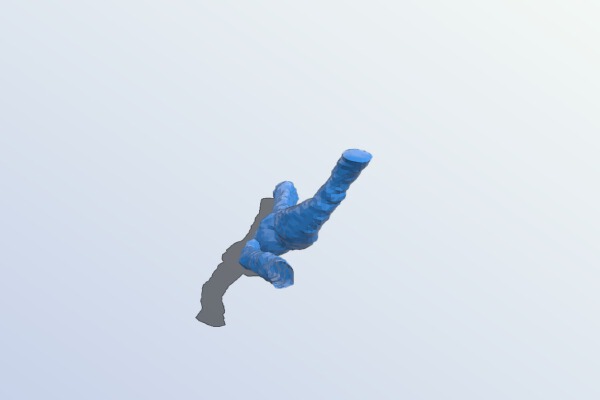 Carotid Artery from MRI | 3d print model