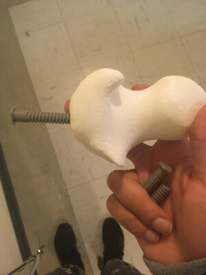 Femur Head with Medical Screw | 3d print model