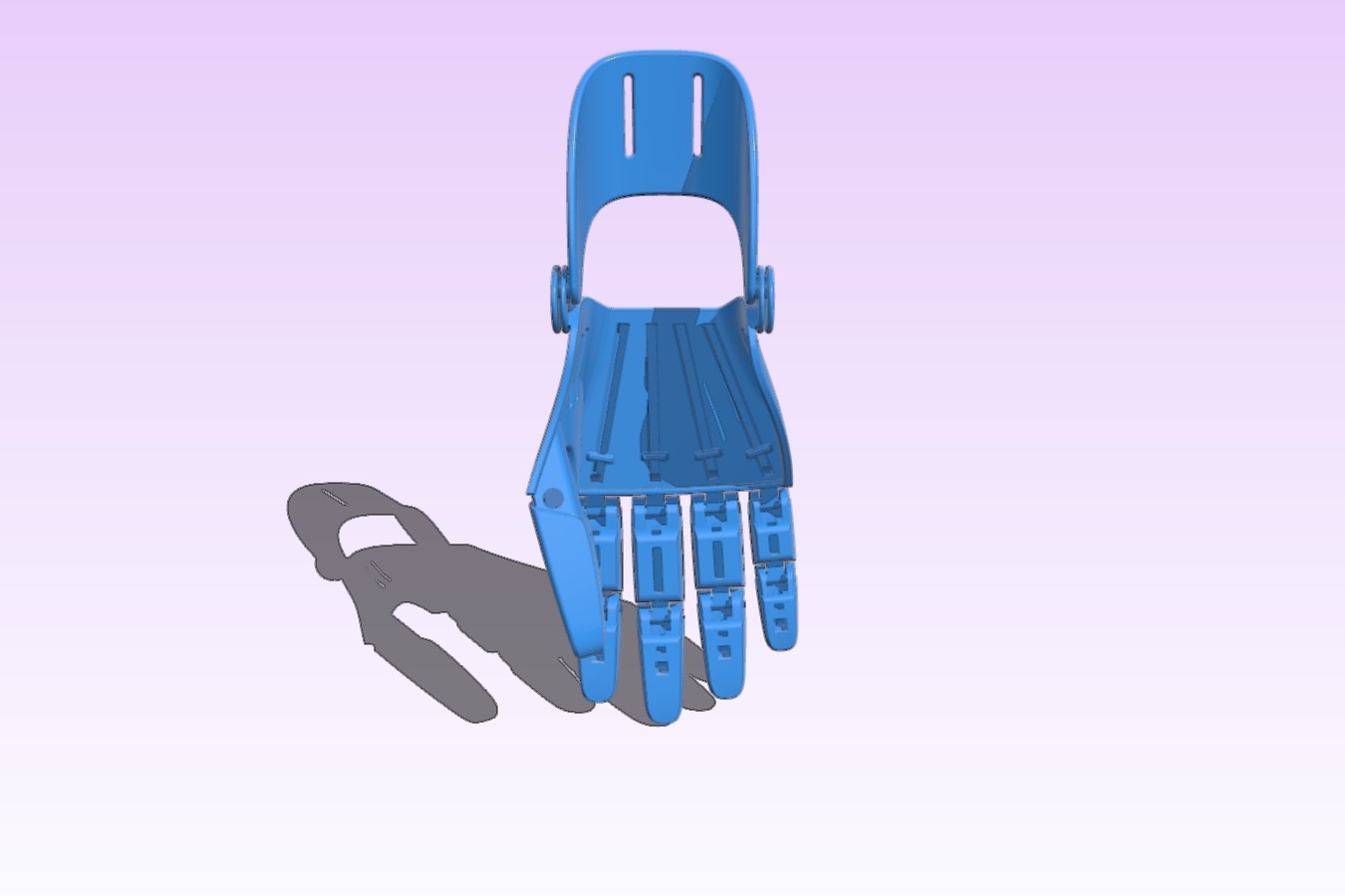 Partial Hand Prosthesis