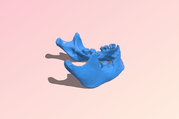3D Scanned Human Mandible _ Jaw Bone | 3d print model
