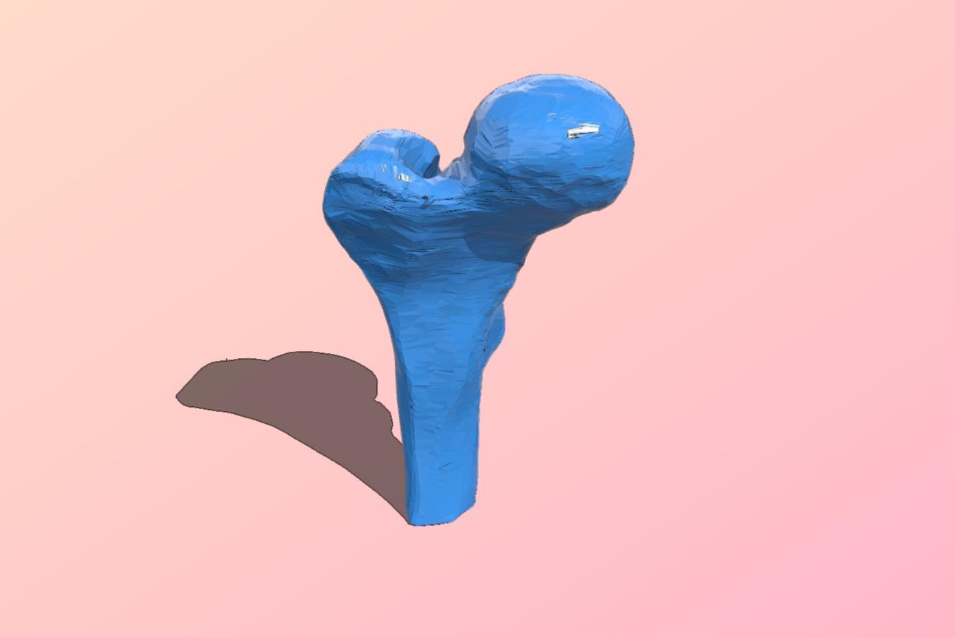 Alberta High School CTS - 3D Printed Bone Replacements