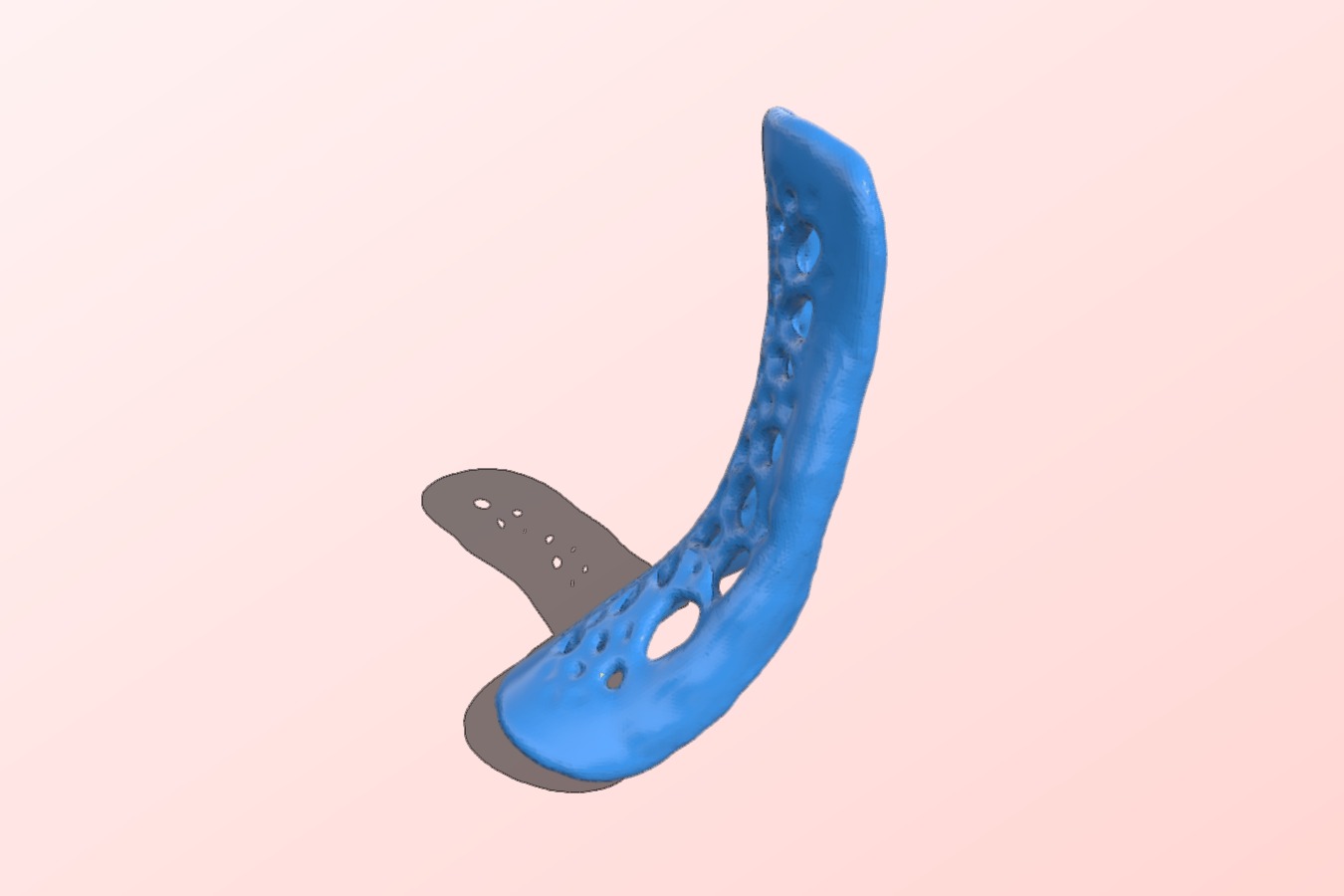 Ankle orthosis