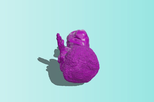 Disco Zombie – Hollow bust | 3d print model