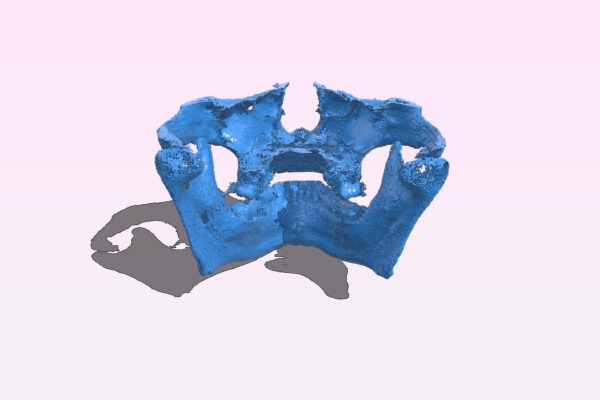 Human mandible and maxilla | 3d print model