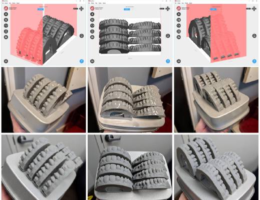 Ortho Models - Combine Platforms - 1,2,3,4,6,8 | 3d print model
