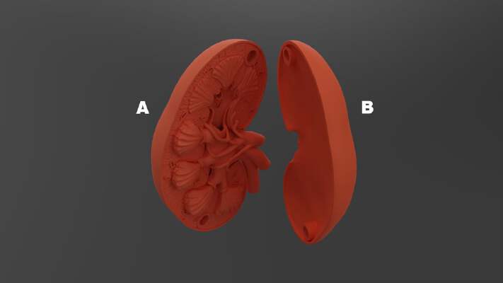 Kidney model | 3d print model