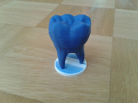 baby tooth box | 3d print model